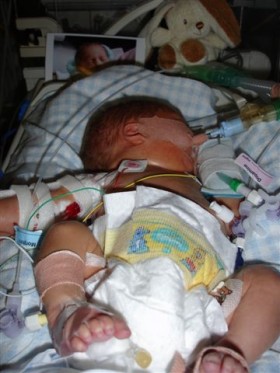 Baby George shortly before he passed away Baby George shortly before he passed away